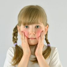 Local Clinical Trial for Pediatric Eczema